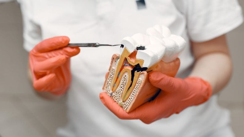 Can Cavities Heal Without Dental Treatment? Find Out